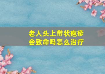 老人头上带状疱疹会致命吗怎么治疗