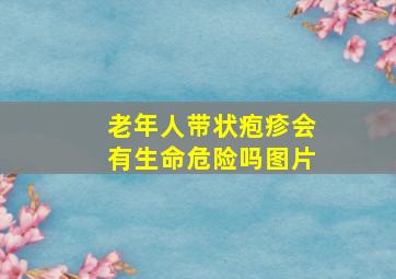 老年人带状疱疹会有生命危险吗图片