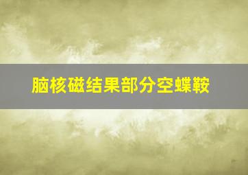 脑核磁结果部分空蝶鞍