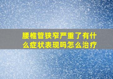 腰椎管狭窄严重了有什么症状表现吗怎么治疗