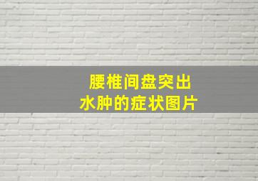 腰椎间盘突出水肿的症状图片