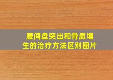 腰间盘突出和骨质增生的治疗方法区别图片