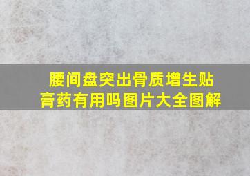 腰间盘突出骨质增生贴膏药有用吗图片大全图解