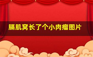 膈肌窝长了个小肉瘤图片