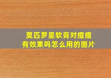 莫匹罗星软膏对痘痘有效果吗怎么用的图片