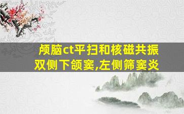 颅脑ct平扫和核磁共振双侧下颌窦,左侧筛窦炎