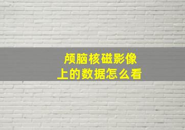 颅脑核磁影像上的数据怎么看