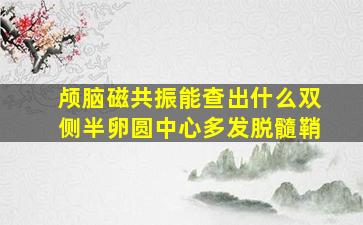 颅脑磁共振能查出什么双侧半卵圆中心多发脱髓鞘